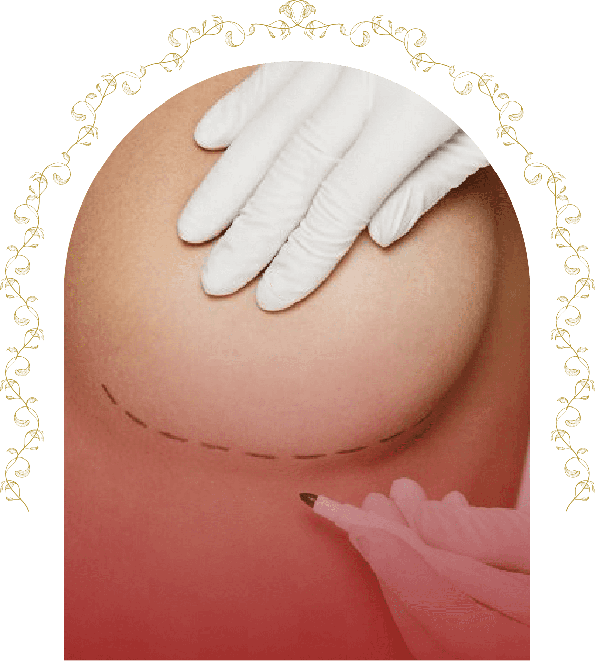 breast augmentation surgery in jaipur